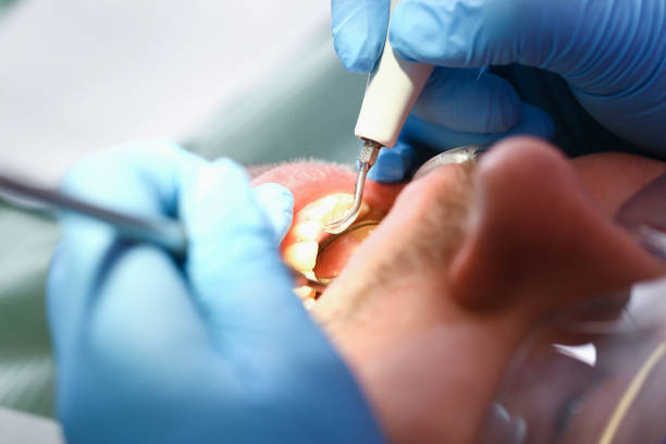 Best After-Hours Emergency Dentist in Harbor Bluffs, FL