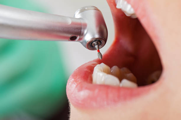 Best Emergency Dental Care for Trauma or Injury in Harbor Bluffs, FL